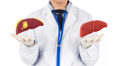 Are YOU suffering from a fatty liver diagnosis?