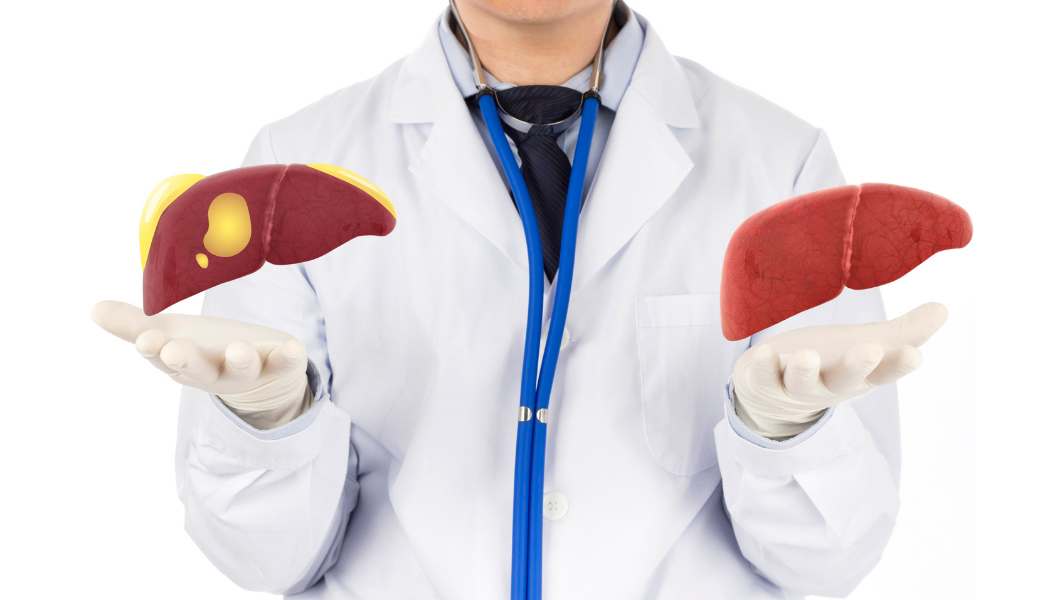 Are YOU suffering from a fatty liver diagnosis?